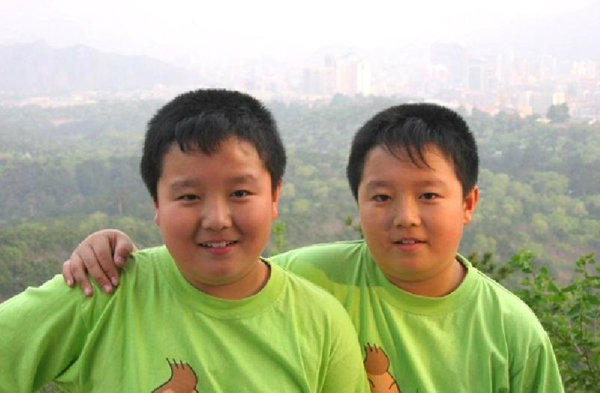 จากหนูน้อยฝาเเฝดพุงพลุ้ยในอดีต สู่ นศ.หนุ่มคู่แฝดจีน ที่หล่อที่สุดในปี 2557