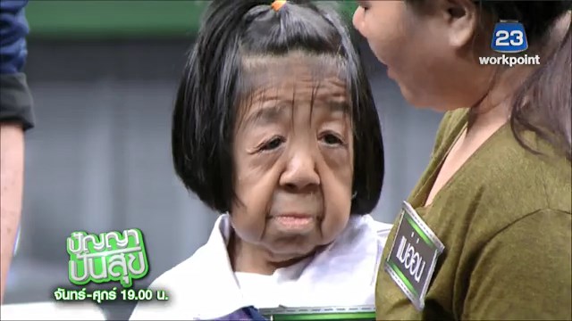 โรคชราในวัยเด็ก