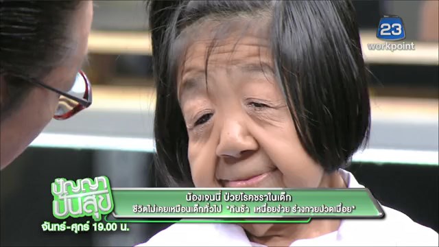 โรคชราในวัยเด็ก