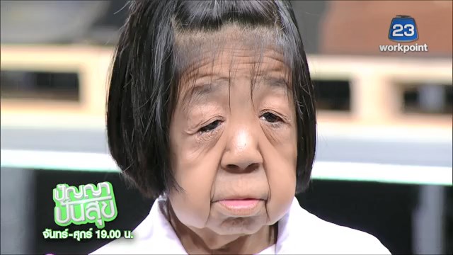 โรคชราในวัยเด็ก