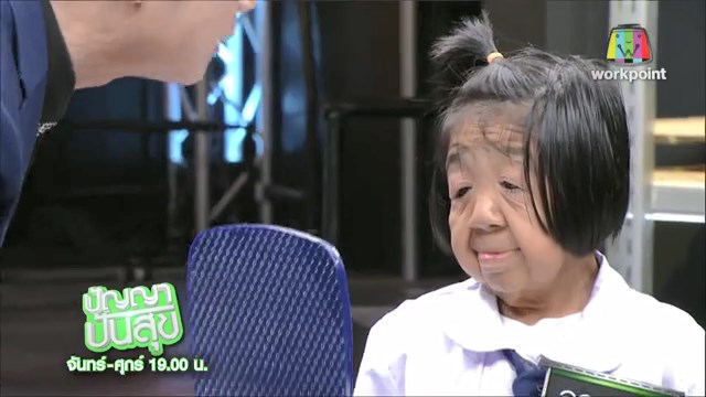 โรคชราในวัยเด็ก