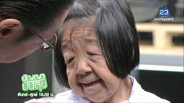 โรคชราในวัยเด็ก