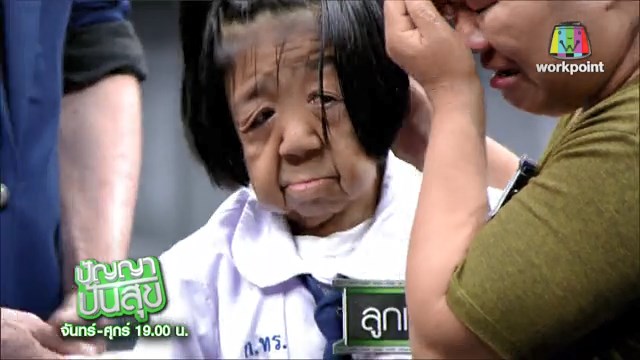 โรคชราในวัยเด็ก