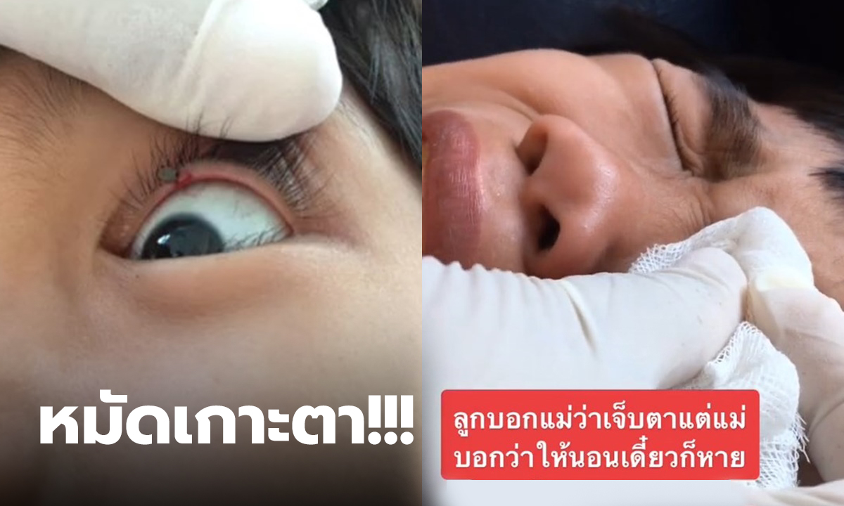 หมัดเกาะตานักเรียน