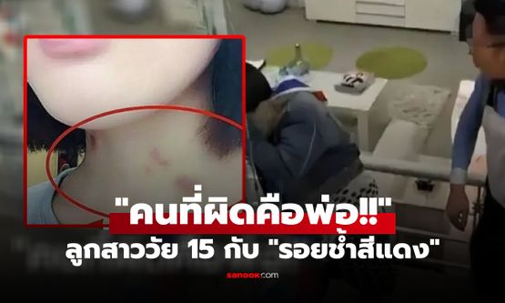 พ่อด่าเดือด ลูกสาววัย 15 บนคอมี "รอยช้ำสีแดง" เจอร่ายยาวโต้กลับ ปัญหาเกิดจากใคร?!