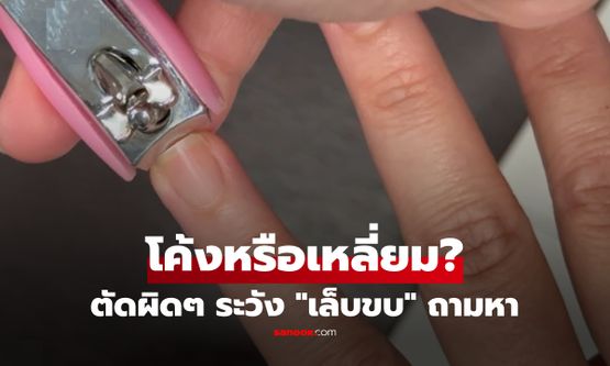 ตัดเล็บโค้งหรือเหลี่ยม? เช็ก 3 จุดพลาด ที่คนส่วนใหญ่ทำประจำ ตัวการนิ้วพัง-เจ็บตัว!!!