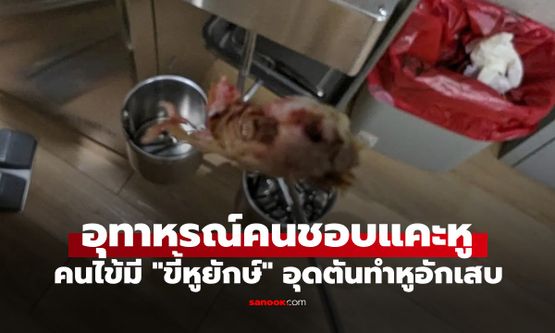 หยุดแคะหู! หมอแชร์ภาพ "ขี้หูยักษ์" ต้นเหตุทำหูอักเสบ เตือนเสี่ยงอันตรายถึงสมอง