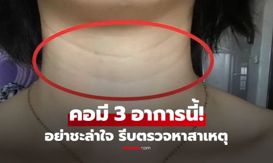 3 สัญญาณผิดปกติที่คอ หากพบแล้วอย่าชะล่าใจ อาจถึงเวลาต้องตรวจหาสาเหตุ
