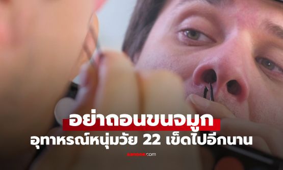 เตือนภัย "ถอนขนจมูก" หนุ่มเสริมหล่อเตรียมไปเดต ผลลัพธ์สุดเจ็บปวดเข็ดไปอีกนาน