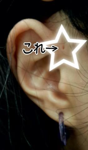 ear-2