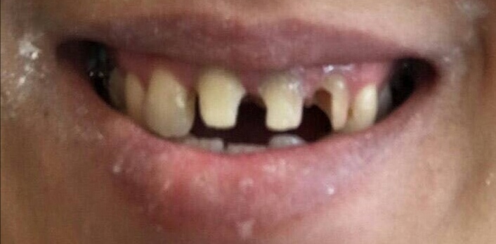 teeth-2