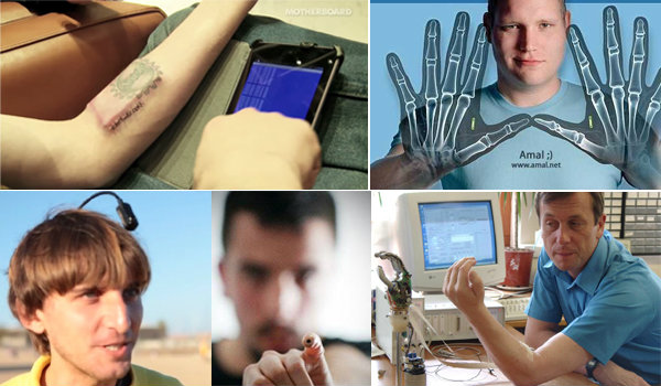 5 หนุ่มมนุษย์ไฮเทคฝัง Gadgets ในร่างกาย