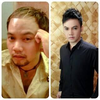 ศัลยกรรมผู้ชาย