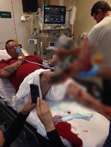 บุหรี่ไฟฟ้าระเบิด