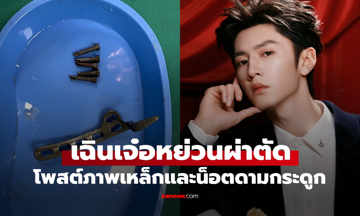ติดฮอตเสิร์ช "เฉินเจ๋อหย่วน" โพสต์ภาพหลังผ่าตัดเหล็กดามกระดูก เห็นแล้วเสียวแทน