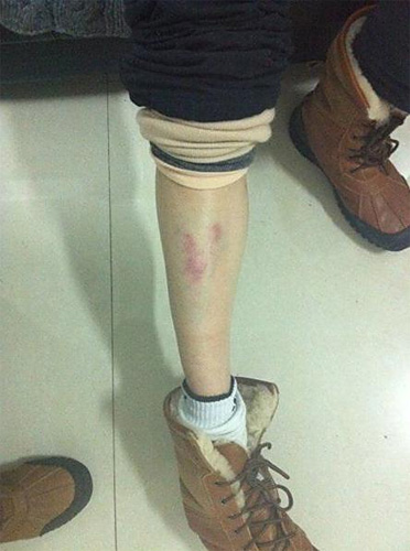 ทีมงานหนังโหด! ซ้อมดาราสาวจีนอ่วม