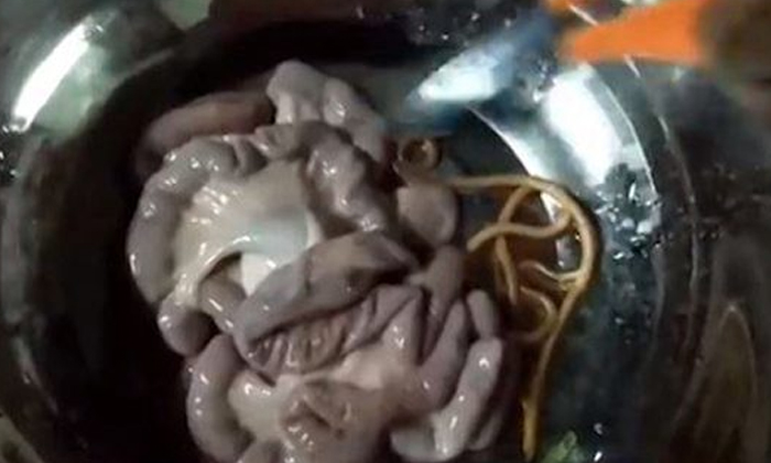 ช็อกตัวประหลาดโผล่ในไส้หมู หมอฟันธงกินได้ แต่ต้องปรุงสุก