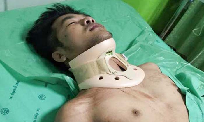 หนุ่มถูกยิงผิดตัว กระสุนฝังในคอเสี่ยงพิการ มือปืนไม่รับผิดชอบ หลัง ตร.ปล่อยตัว