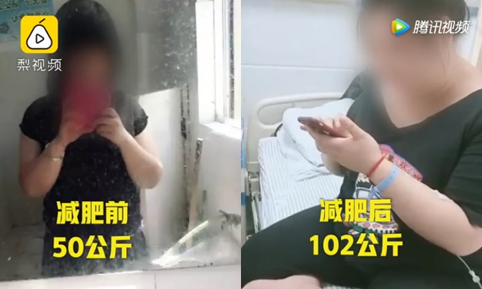 สาวจีนกินยาลดความอ้วนติดต่อกัน 7 ปี แต่น้ำหนักกลับพุ่งขึ้น-ร่างขยาย