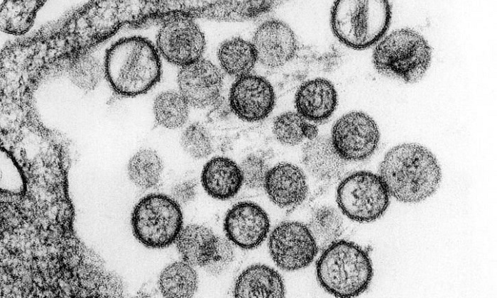 "ไวรัสฮันตา" เชื้อโรคมรณะ-รักษาไม่ได้ ระบาดอาร์เจนตินา ตายแล้ว 11 คน