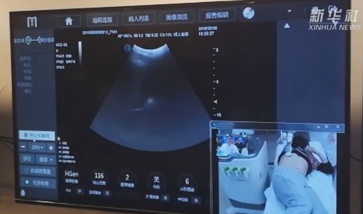 ก้าวหน้าอีกขั้น แพทย์จีนใช้เทคโนโลยี 5G อัลตราซาวด์ทางไกล