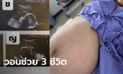 สาวท้อง 8 เดือน เคยป่วยโควิด วอนขอเตียงผ่าคลอดลูกแฝดชาย-หญิง ยังไม่มี รพ.ไหนรับ