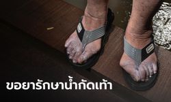 น้ำท่วมนนทบุรี ชาวบ้านร้องขอยารักษา "โรคน้ำกัดเท้า" คุณยายโชว์เท้าเป็นขนาดนี้แล้ว