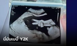 ไม่ได้ตัดต่อ! ภาพอัลตราซาวด์ ทารกโพสต์ท่าชู 2 นิ้วคูลๆ นี่มันเบบี๋ Y2K