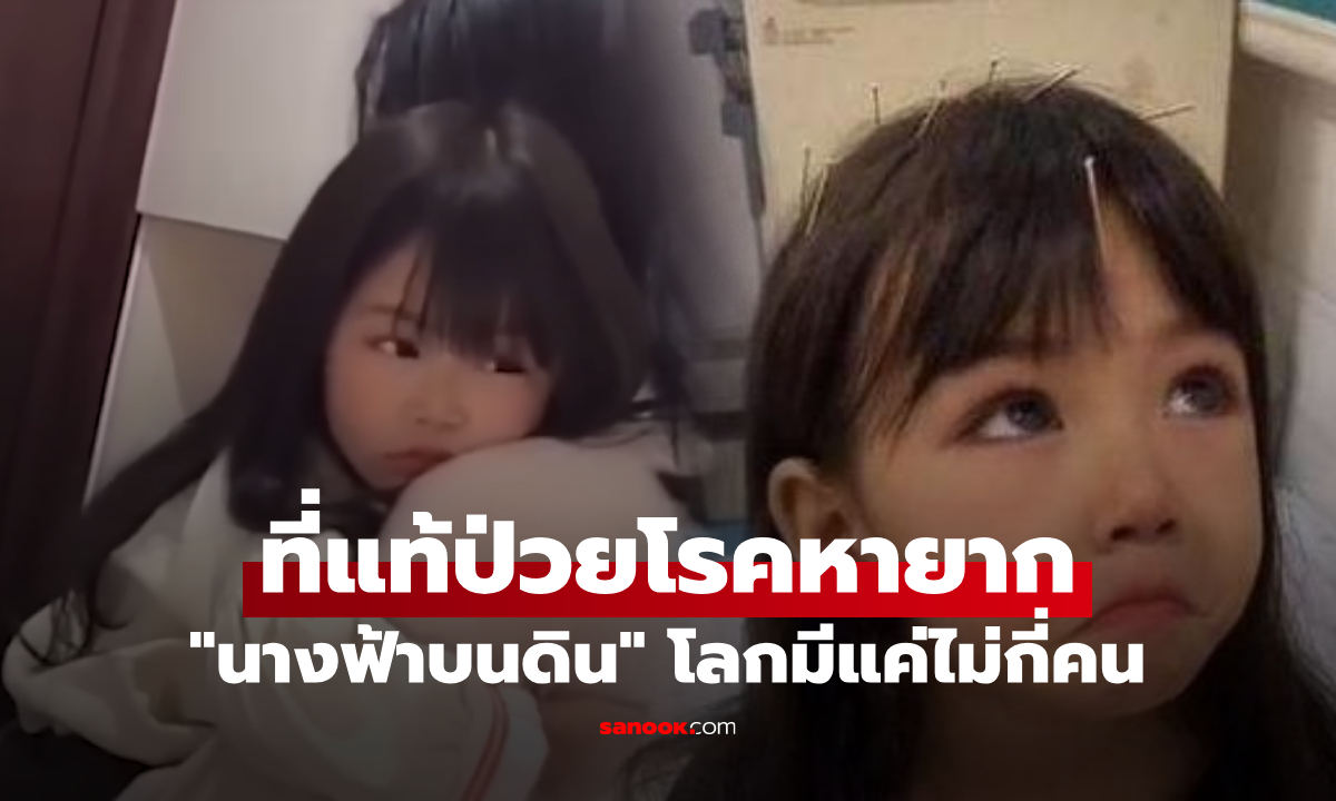 สวยปนเศร้า.... “นางฟ้าบนดิน” เด็กมีใบหน้าเทพธิดา ที่แท้ป่วยโรคหายาก บนโลกมีไม่กี่คน!