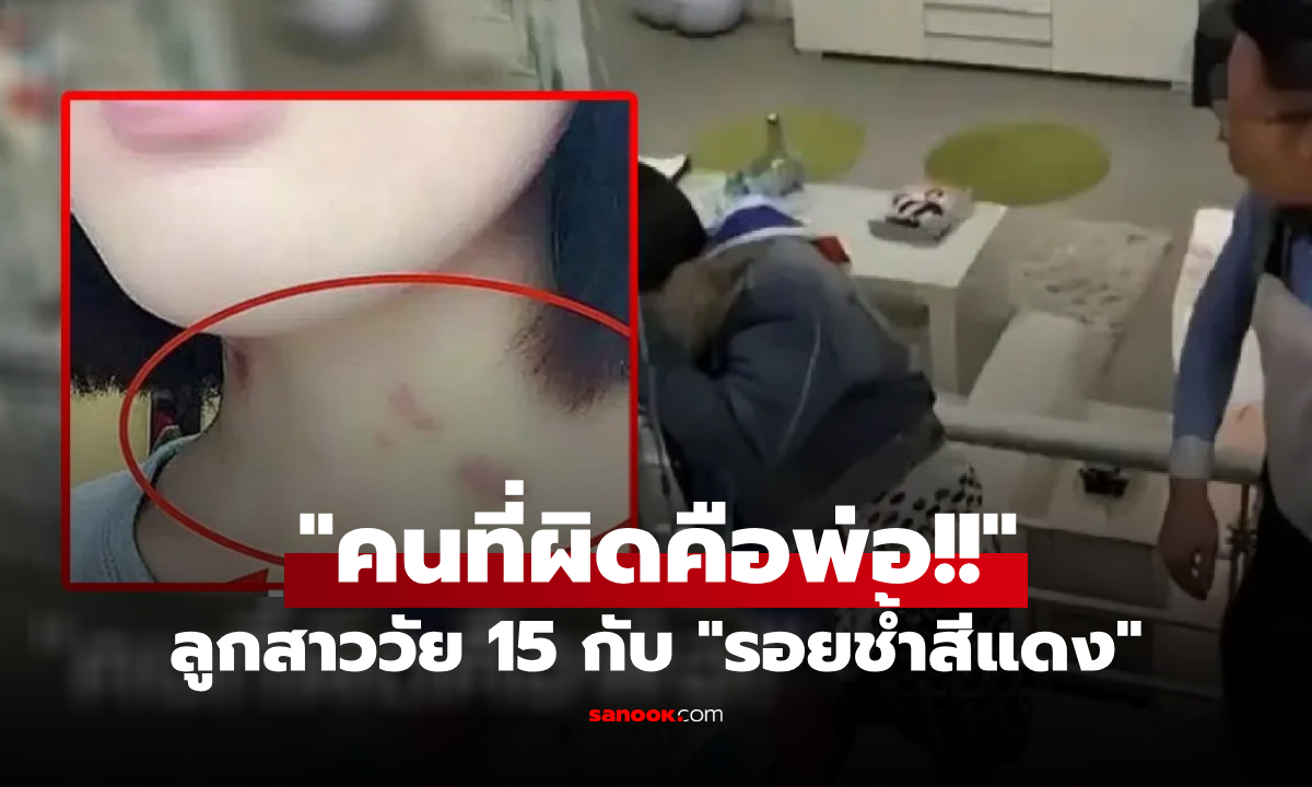 พ่อด่าเดือด ลูกสาววัย 15 บนคอมี "รอยช้ำสีแดง" เจอร่ายยาวโต้กลับ ปัญหาเกิดจากใคร?!