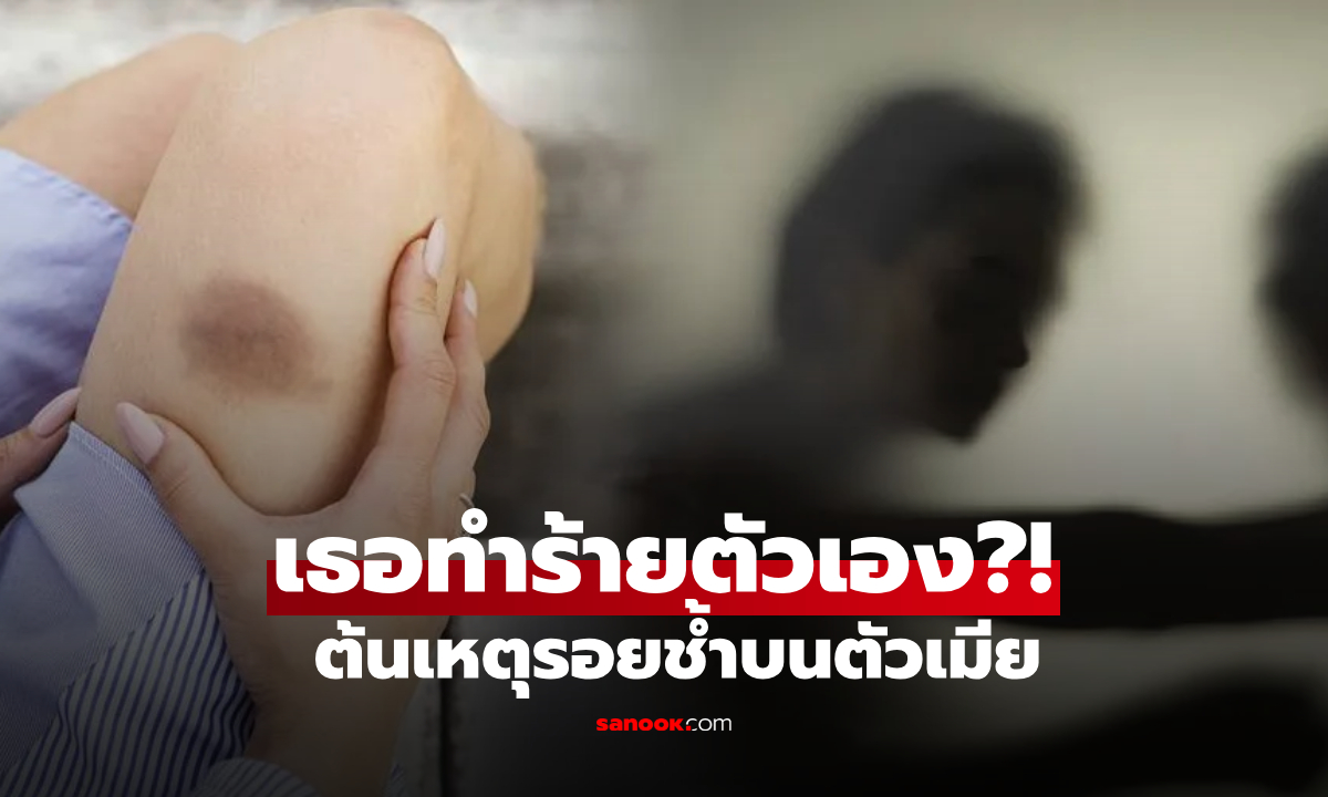สามีสงสัย เมียมี "รอยฟกช้ำ" กระจายทั่วตัว ติดกล้องแอบดูรู้ต้นเหตุ รีบกลับบ้านเยียวยาใจ!