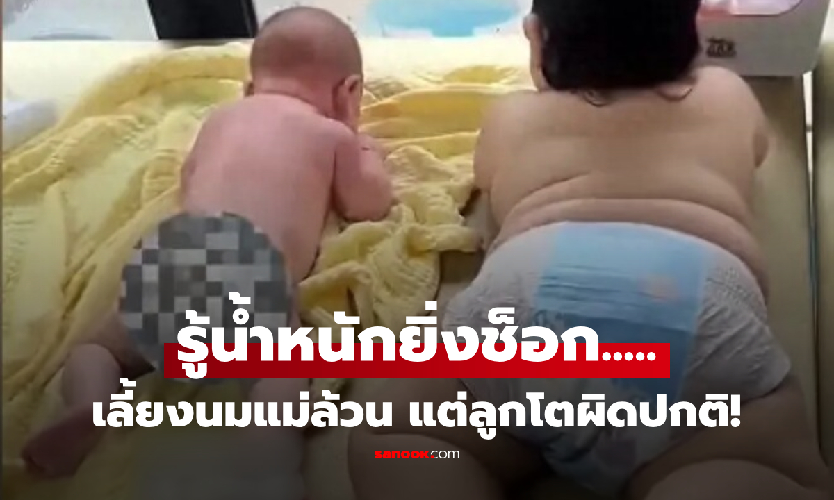 รูปสะเทือนใจ ทารกวัย 5 เดือน โตกว่าพี่ชาย "เป็นเท่าตัว!" แม่ช็อก ฟังคำเตือนจากปากแพทย์