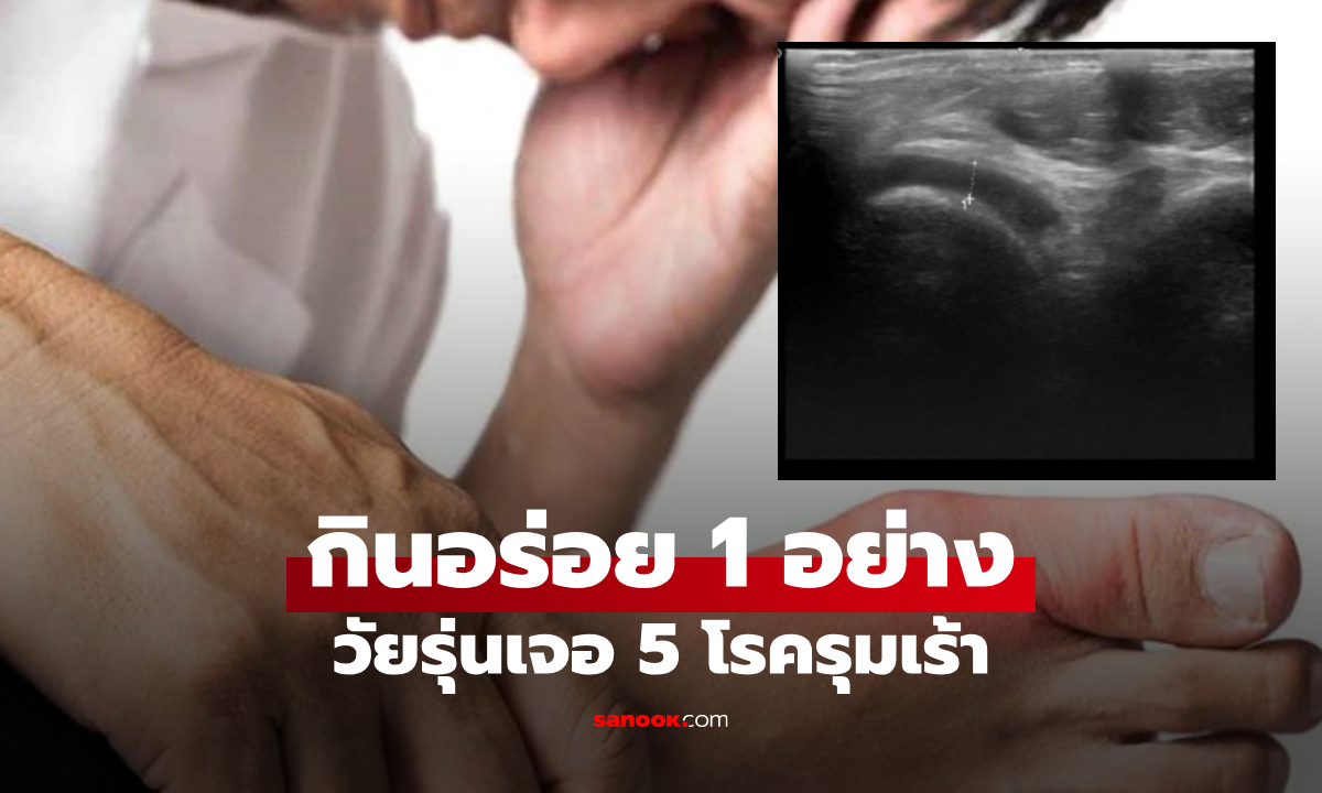 หนุ่มวัย 22 ช็อกเพิ่งรู้ "อาหารโปรด" เปิดประตูสู่ 5 โรครุมเร้า เกาต์-ไขมัน-โพลิป เป็นครบ!!!