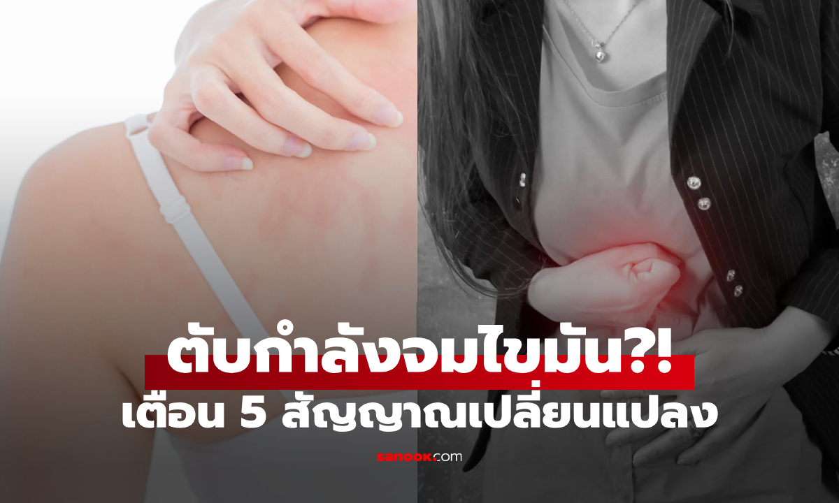 ตับเตือน "จมไขมัน" ร่างกายส่ง 5 สัญญาณ ขี้ลืม-คันผิว ก็อยู่ในลิสต์ แต่ยังไม่ใช่ข้อแรก!