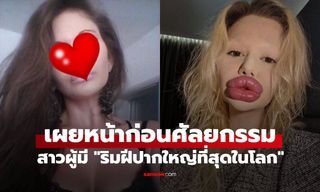 หญิงผู้ถูกขนานนามว่ามี "ริมฝีปากใหญ่ที่สุดในโลก" เผยใบหน้าก่อนศัลยกรรม