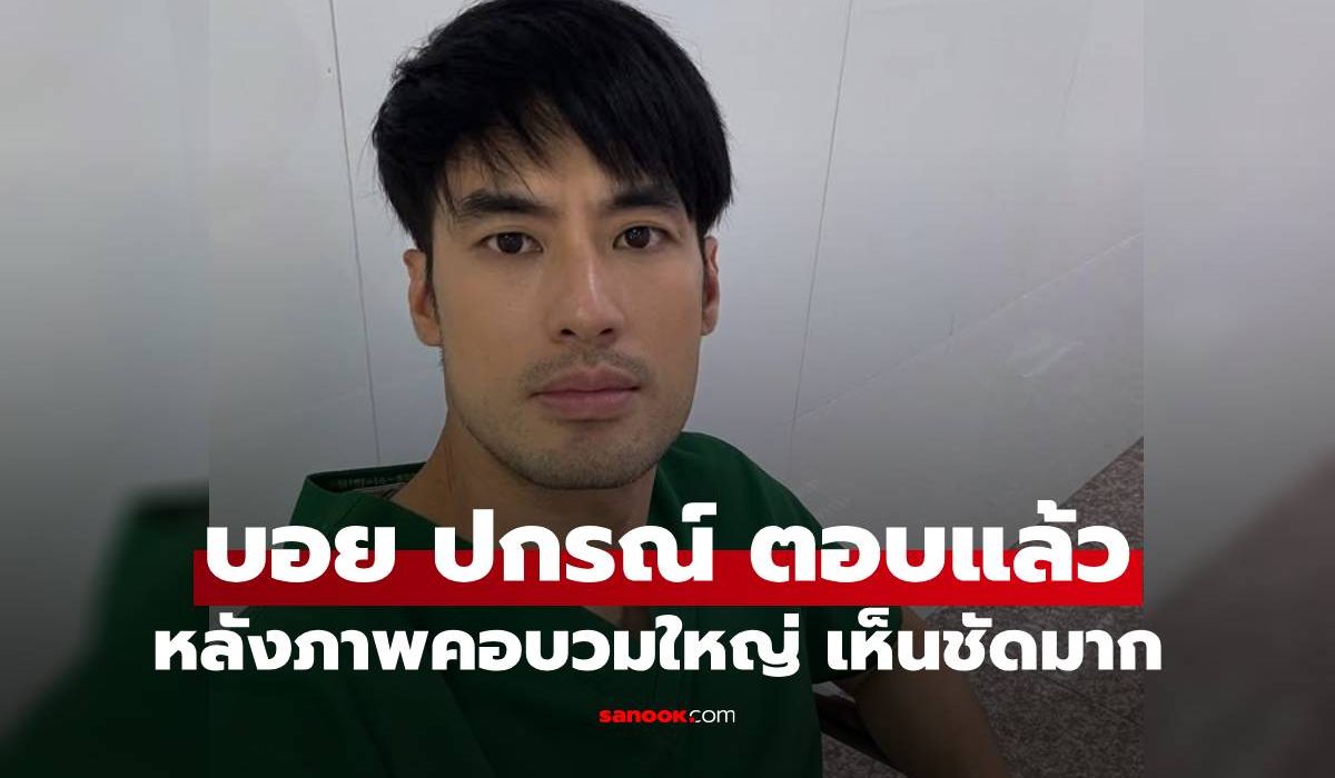 "บอย ปกรณ์" แจงละเอียด หลังมีภาพคอบวมผิดปกติ ขอบคุณทุกคนที่เป็นห่วง