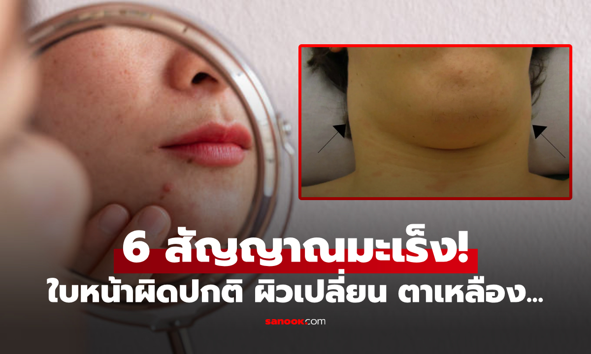 เผย 6 สัญญาณร้าย บ่งชี้ "มะเร็ง" จากใบหน้าและลำคอ สังเกตได้ง่ายๆ แค่ส่องกระจก!