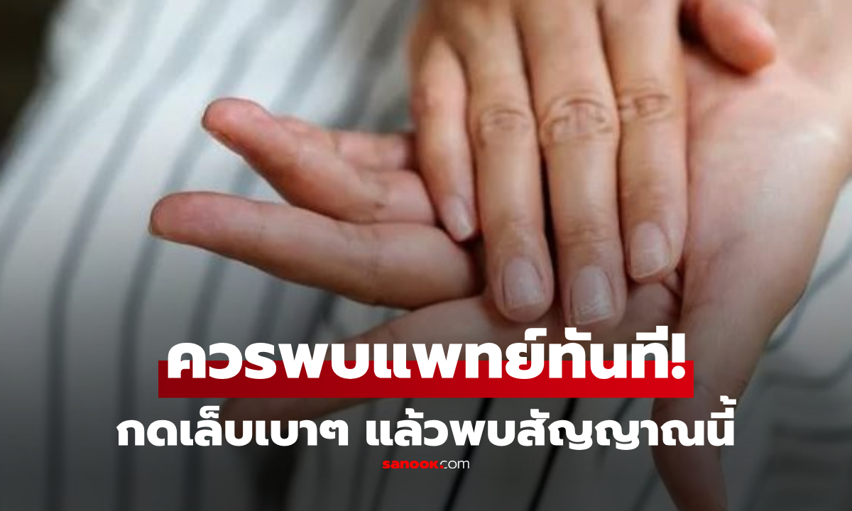 หมอเตือนเอง "กดเล็บ" แล้วเจอสัญญาณนี้ ควรไปพบแพทย์ทันที เสี่ยงโรคหัวใจร้ายแรง!