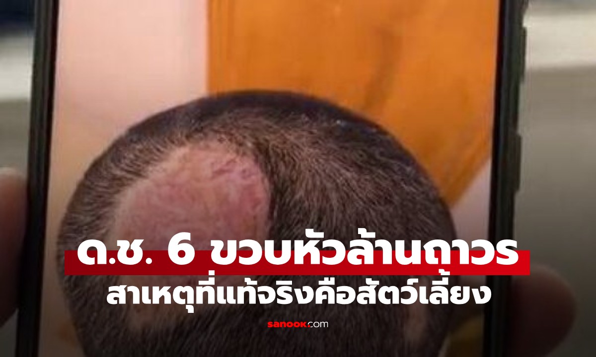 ผปค.ต้องระวัง! เคสอุทาหรณ์ ด.ช.6 ขวบ หัวล้านถาวร สาเหตุที่แท้จริงคือสัตว์เลี้ยง