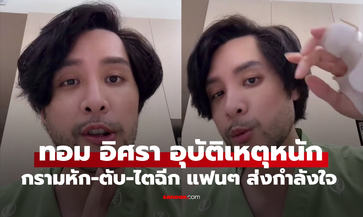 แฟนคลับตกใจ "ทอม อิศรา" ประสบอุบัติเหตุหนัก กรามหัก-ตับไตฉีก ส่งกำลังใจล้นหลาม