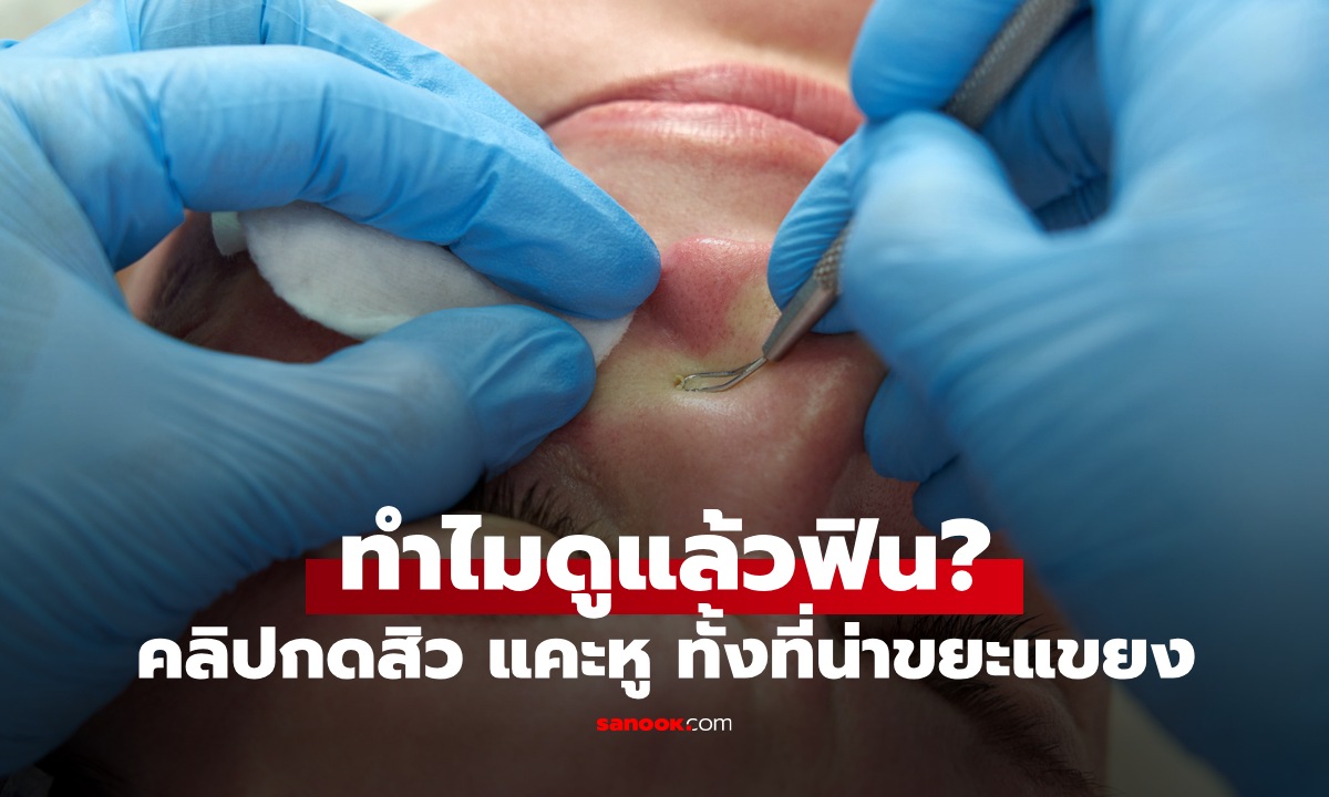 นี่ร่างกายเราเป็นอะไร? ดูคลิปกดสิว ตัดเล็บขบ แคะหู ทำไมรู้สึกฟิน เพลินจนหยุดดูไม่ได้