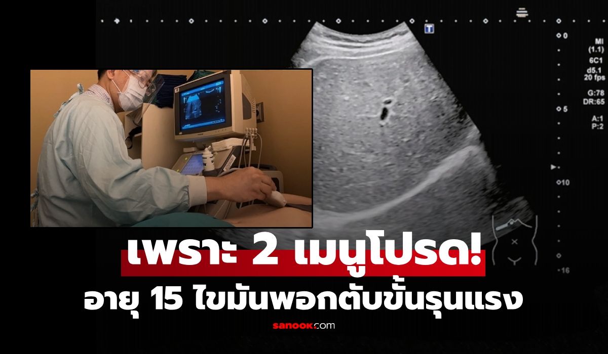 นร.อายุแค่ 15 ไขมันพอกจน "ตับขาวซีด" หมอบอกตรงๆ เพราะ 2 เมนูโปรด ที่ใครก็ชอบกิน!