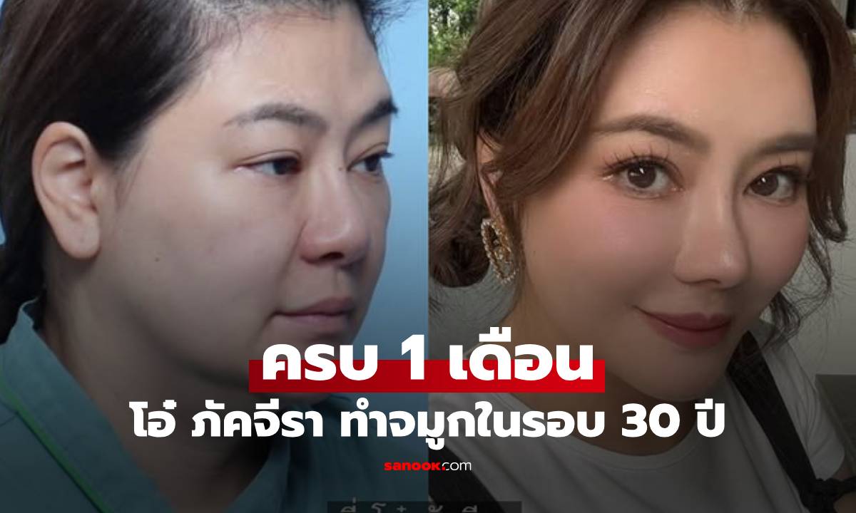 อัปเดตหน้า! "โอ๋ ภัคจีรา" หลังทำจมูกใหม่ในรอบ 30 ปี ครบ 1 เดือน