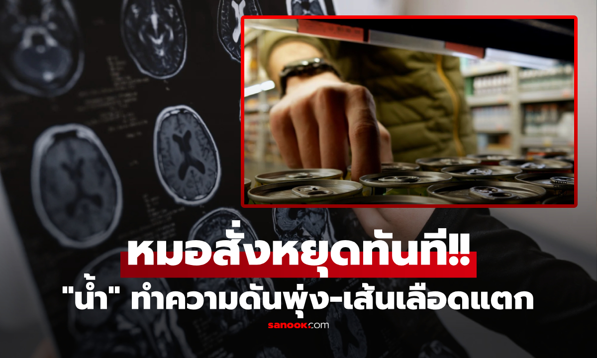 ชายแข็งแรง ไม่เหล้า-บุหรี่ จู่ๆ เส้นเลือดสมองแตก แพทย์รู้ "เครื่องดื่มโปรด" สั่งให้เลิกเดี๋ยวนี้!