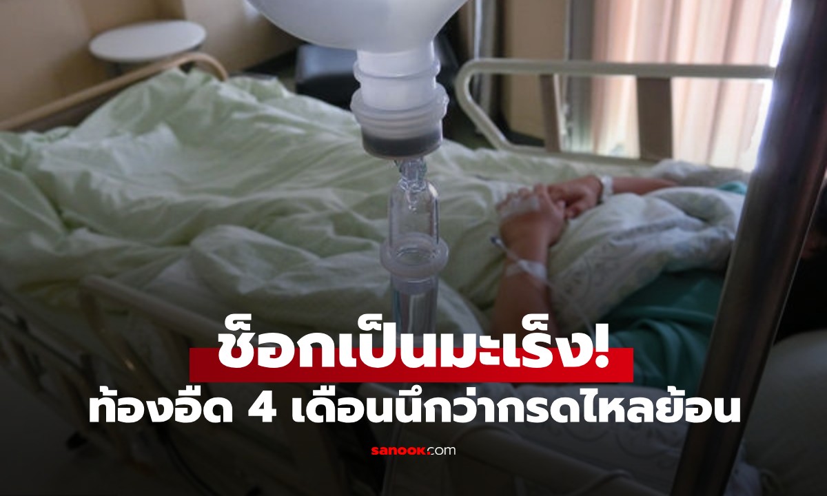 ท้องอืด 4 เดือน ช็อกเป็นมะเร็ง! หมอเผย 10 สัญญาณเตือนโรคร้ายที่ห้ามมองข้าม