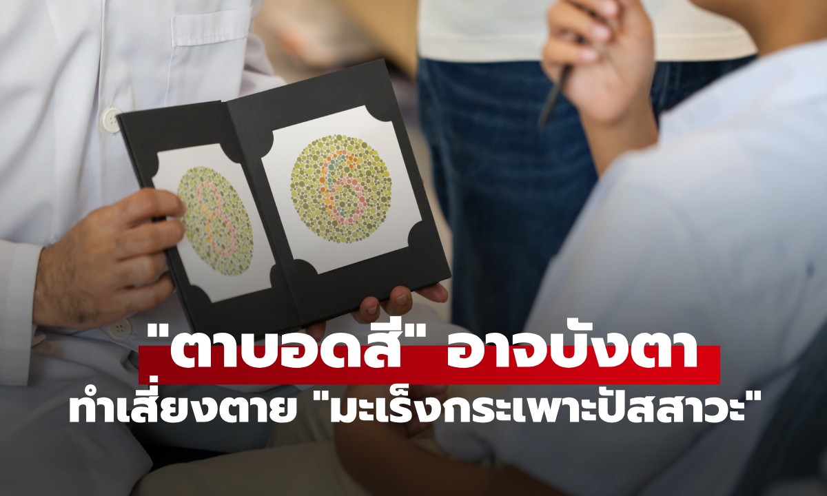 เตือนภัยเงียบ! "ตาบอดสี" อาจบังตา ทำเสี่ยงตาย "มะเร็งกระเพาะปัสสาวะ"