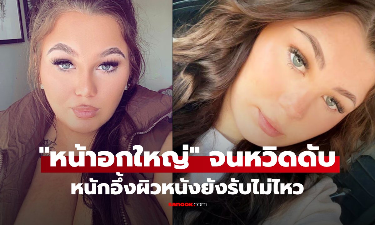 สาววัย 21 ทนทุกข์ "หน้าอกโต" หนักจนผิวหนังขาด! แต่กฎหมายตลกร้าย ไม่ให้ผ่าลดขนาด