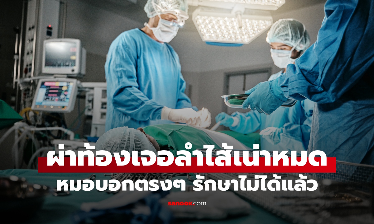 คนไข้ปวดท้อง หมออึ้งลำไส้ "เน่าทั้งหมด" ภาวะฉุกเฉินที่แพทย์กุมขมับ เสียชีวิตในวันเดียว