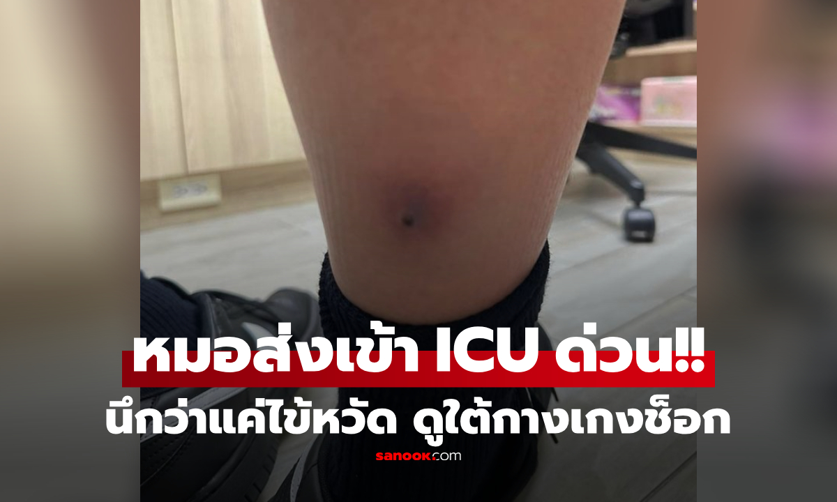 นึกว่าแค่หวัด! เด็กชาย 12 ขวบไข้กลับ หมอเอะใจขอดู "ใต้กางเกง" สั่งหามส่ง ICU ด่วน