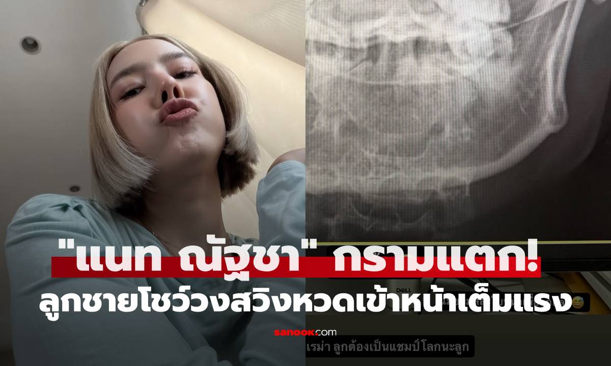 "แนท ณัฐชา" กรามแตก! หลัง "น้องเรม่า" ลูกชายโชว์วงสวิงหวดเข้าหน้าเต็มแรง